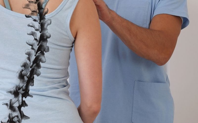 scoliosis